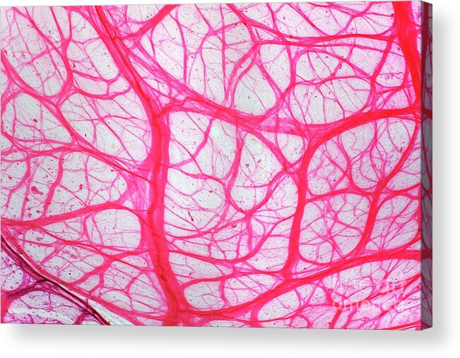 Tissue Acrylic Print featuring the photograph Bladder Tissue by Dr Keith Wheeler/science Photo Library