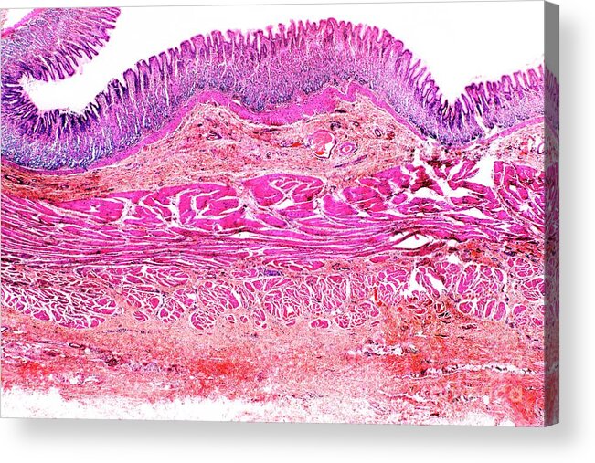 Stomach Acrylic Print featuring the photograph Stomach Wall by Dr Keith Wheeler/science Photo Library