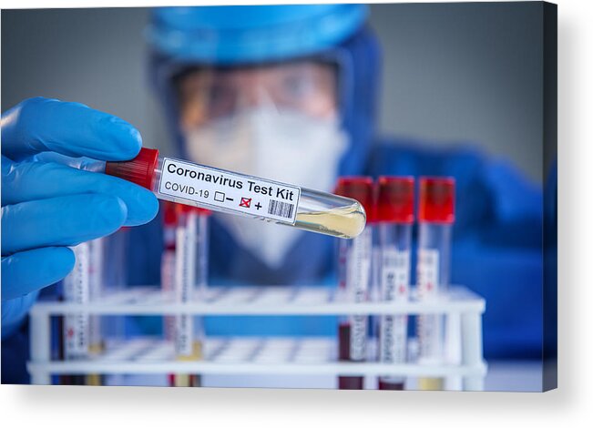 Medical Research Acrylic Print featuring the photograph Examining coronavirus COVID 19 medical samples on kits novel corona virus outbreak #1 by Hocus-focus