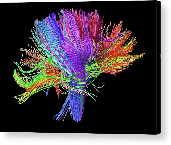 Brain Scan Acrylic Print featuring the photograph White Matter Fibres Of The Human Brain #11 by Alfred Pasieka