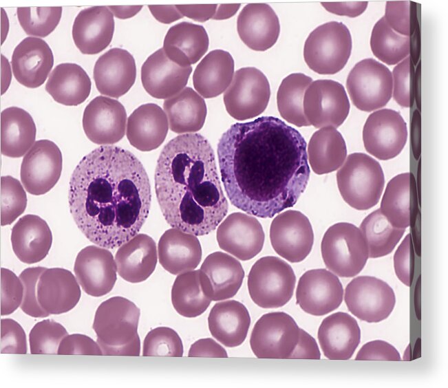 Blood Acrylic Print featuring the photograph Red And White Blood Cells, Lm #2 by Alvin Telser