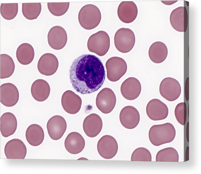 Blood Acrylic Print featuring the photograph Red And White Blood Cells, Lm #3 by Alvin Telser