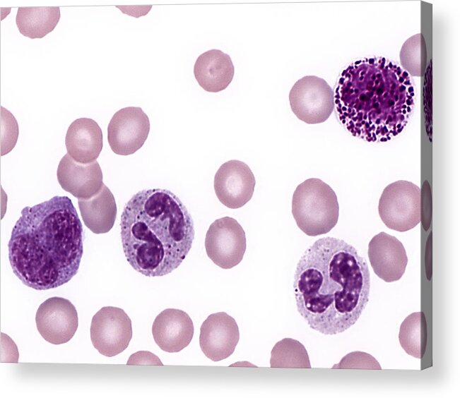 Blood Acrylic Print featuring the photograph Red And White Blood Cells, Lm #4 by Alvin Telser