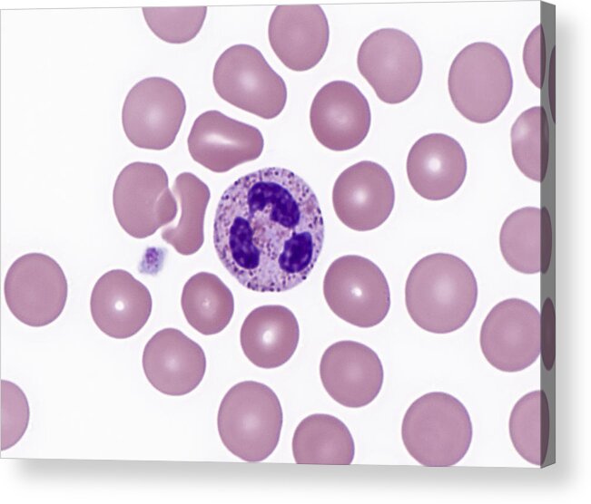 Blood Acrylic Print featuring the photograph Red And White Blood Cells, Lm #5 by Alvin Telser