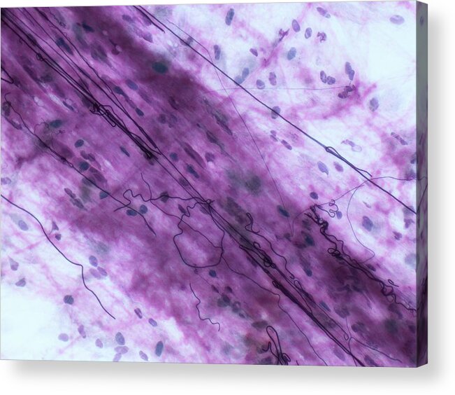 Connective Tissue Acrylic Print featuring the photograph Elastin Fibers by Steve Gschmeissner