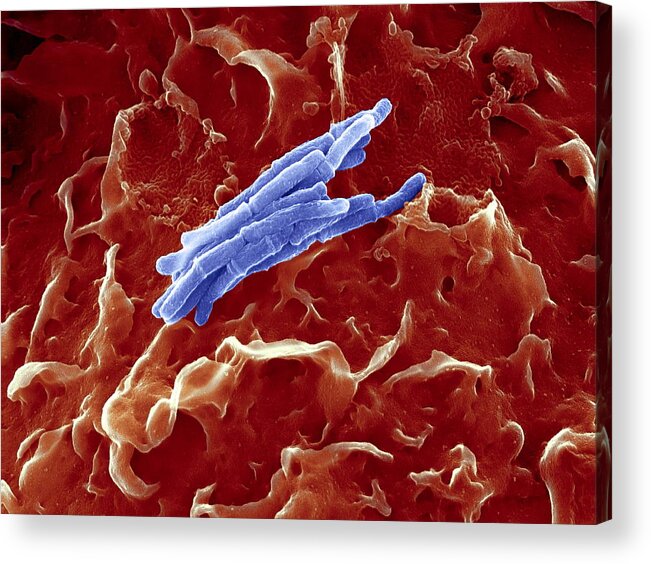 Mycobacterium Tuberculosis Acrylic Print featuring the photograph Bacteria Infecting A Macrophage, Sem #1 by 