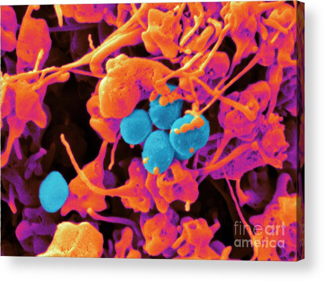 Platelets Acrylic Print featuring the photograph Human Platelets & Staphylococcus, Sem by Scimat