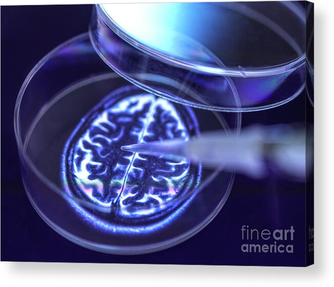 Dementia Acrylic Print featuring the photograph Neurology Research #8 by Tek Image/science Photo Library