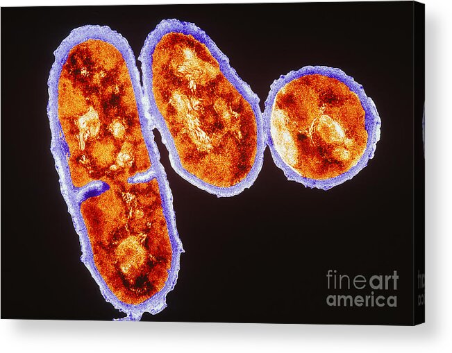 Propionibacterium Acnes Acrylic Print featuring the photograph Tem Propionibacterium Acnes #5 by Kwangshin Kim