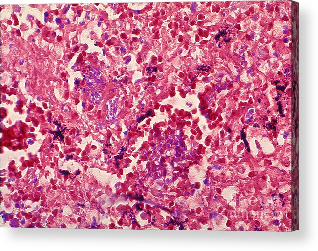 Science Acrylic Print featuring the photograph Bacillus Anthracis, Lm #1 by Science Source