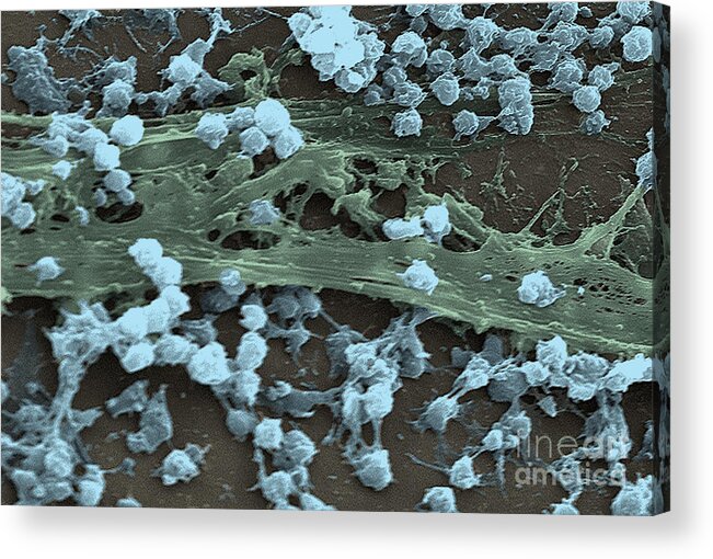 Science Acrylic Print featuring the photograph Staphylococcus Aureus Bacteria, Sem #1 by Science Source