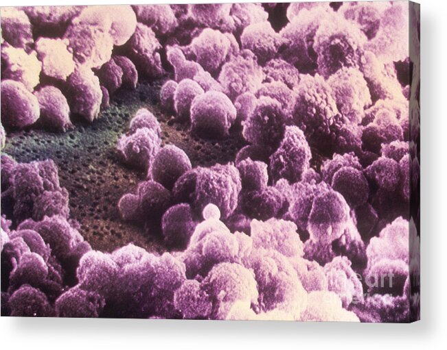 Medical Acrylic Print featuring the photograph Aids Virus Sem by Science Source