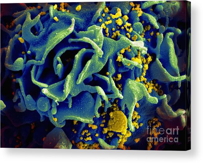Microbiology Acrylic Print featuring the photograph Hiv-infected T Cell, Sem by Science Source