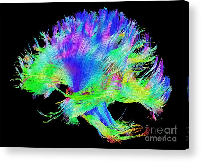 Brain Mri Acrylic Print featuring the photograph Fiber Tracts Of The Brain, Dti by Living Art Enterprises