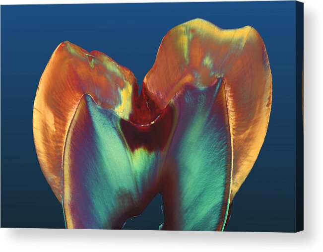 Enamel Acrylic Print featuring the photograph Polarised Lm Of A Molar Tooth Showing Decay by Volker Steger