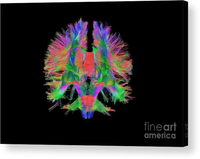 Brain Acrylic Print featuring the photograph Brain Fibres Front View by Do Tromp/science Photo Library