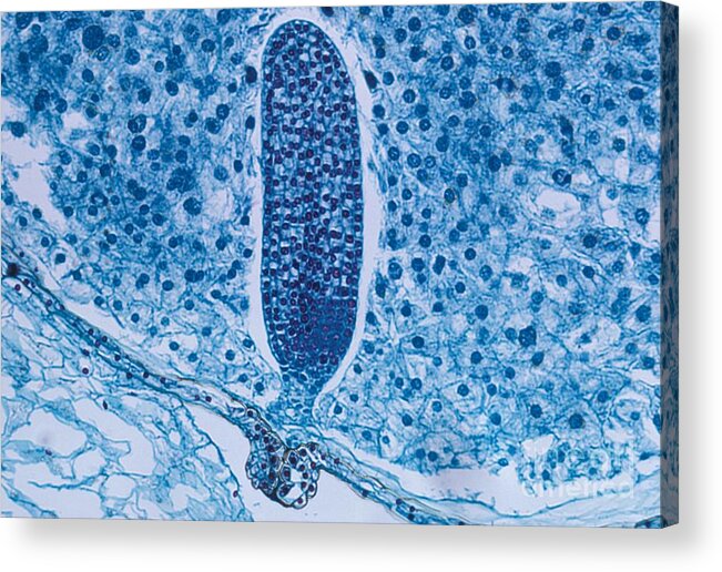 Lm Acrylic Print featuring the photograph Lily Embryo. Lm by Carolina Biological Supply Company/science Photo Library