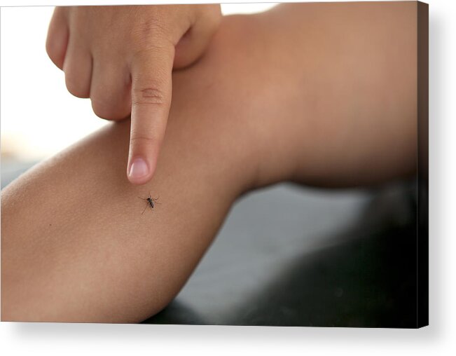 Child Acrylic Print featuring the photograph A mosquito on small kid's leg by Thanasis Zovoilis