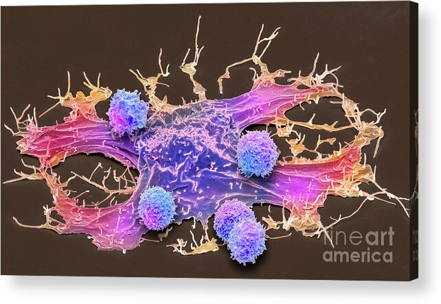 Abnormal Acrylic Print featuring the photograph Car T-cell Therapy #17 by Steve Gschmeissner/science Photo Library