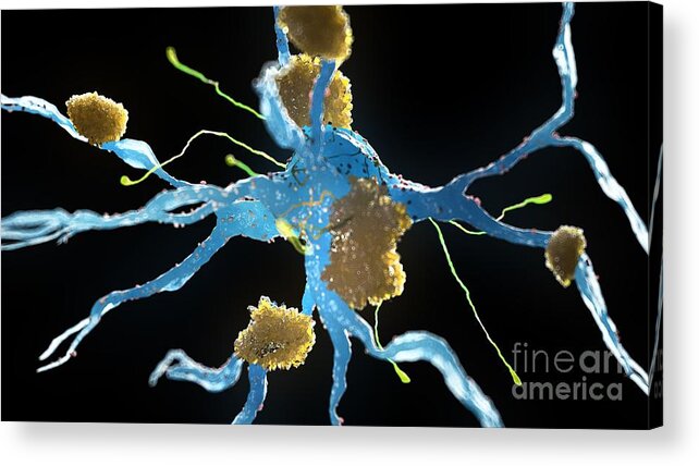 Nerve Cell Acrylic Print featuring the photograph Alzheimer's Nerve Cells #2 by Sebastian Kaulitzki/science Photo Library
