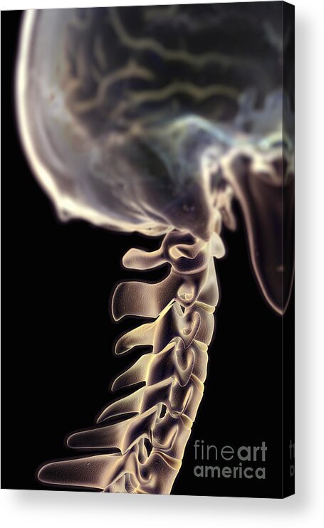 Human Body Acrylic Print featuring the photograph Cervical Vertebrae #4 by Science Picture Co