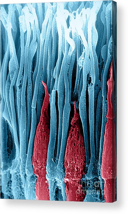 Photoreceptor Acrylic Print featuring the photograph Rods And Cones Sem #5 by Ralph C. Eagle, Jr.