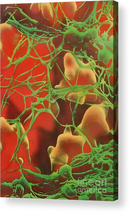 Blood Clots Acrylic Print featuring the photograph Blood Clots by David M. Phillips