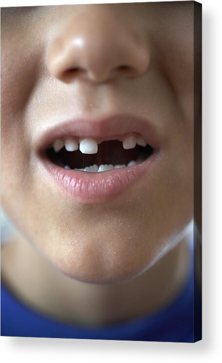 Human Mouth Acrylic Print featuring the photograph Boy (6-8) with gap in teeth, close-up by Thomas Northcut