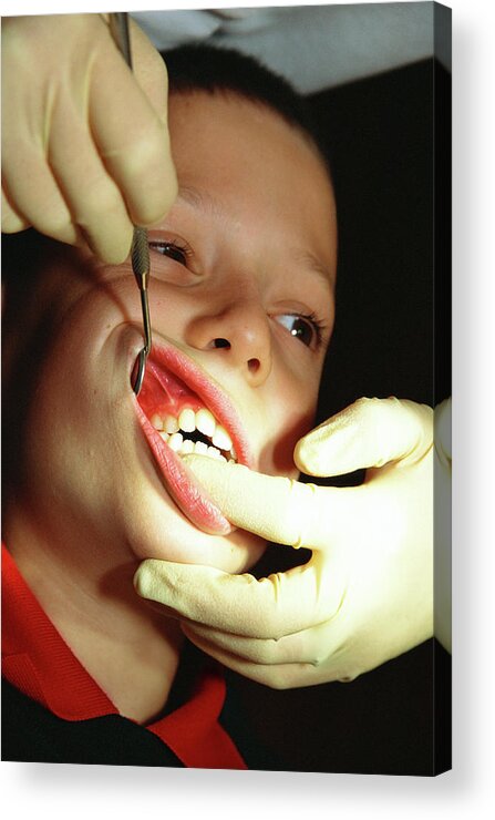 Boy Acrylic Print featuring the photograph Orthodontic Examination by Antonia Reeve/science Photo Library