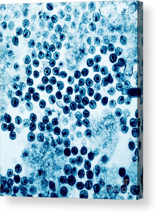 Aids Acrylic Print featuring the photograph Hiv Virus #2 by David M. Phillips