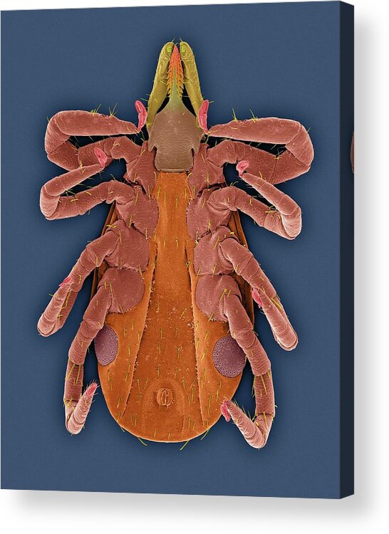 Arachnids Acrylic Print featuring the photograph Deer Tick (ixodes Scapularis) #6 by Dennis Kunkel Microscopy/science Photo Library