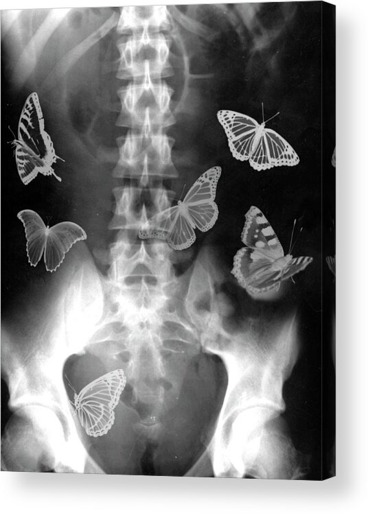 Abdomen Acrylic Print featuring the photograph Butterflies In The Stomach by Photostock-israel