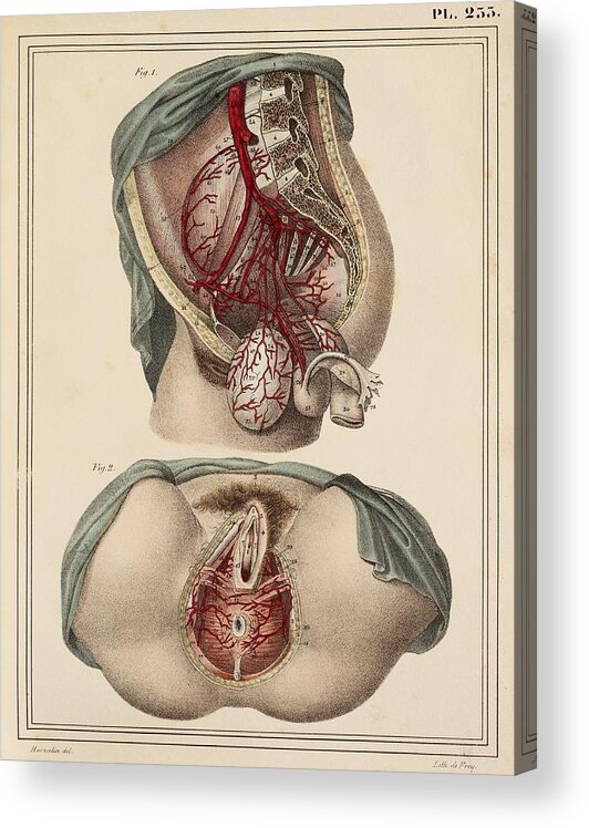 Female groin arteries, 1825 artwork Acrylic Print by Science Photo