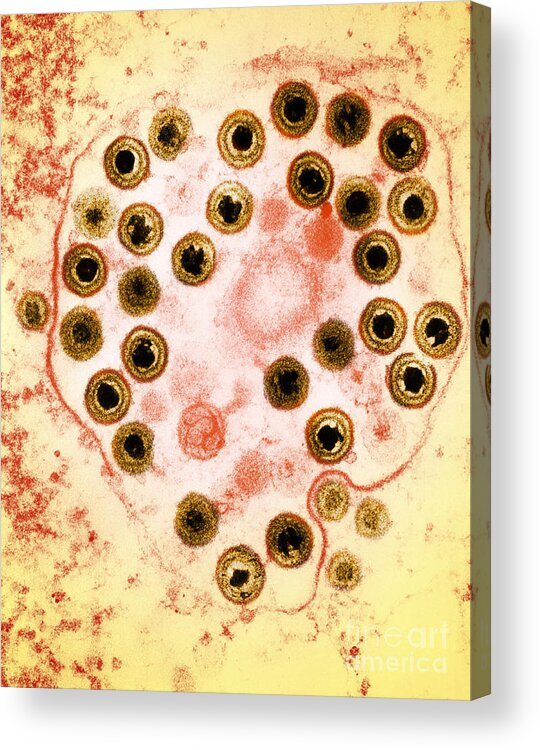 Herpes Simplex Virus Acrylic Print featuring the photograph Herpes by Science Source