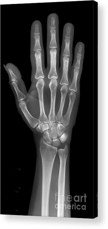 Hand Acrylic Print featuring the photograph Normal Hand by Ted Kinsman