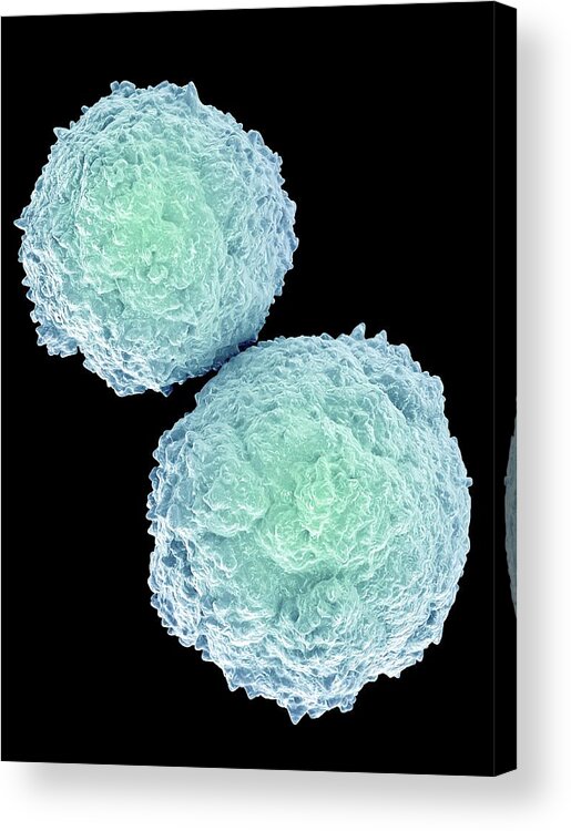 T Lymphocyte Acrylic Print featuring the photograph T-lymphocytes #5 by Maurizio De Angelis