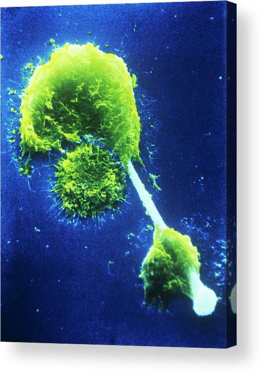 Magnified Image Acrylic Print featuring the photograph Sem Of Macrophages Impaled On An Asbestos Needle by Photo Insolite Realite/science Photo Library
