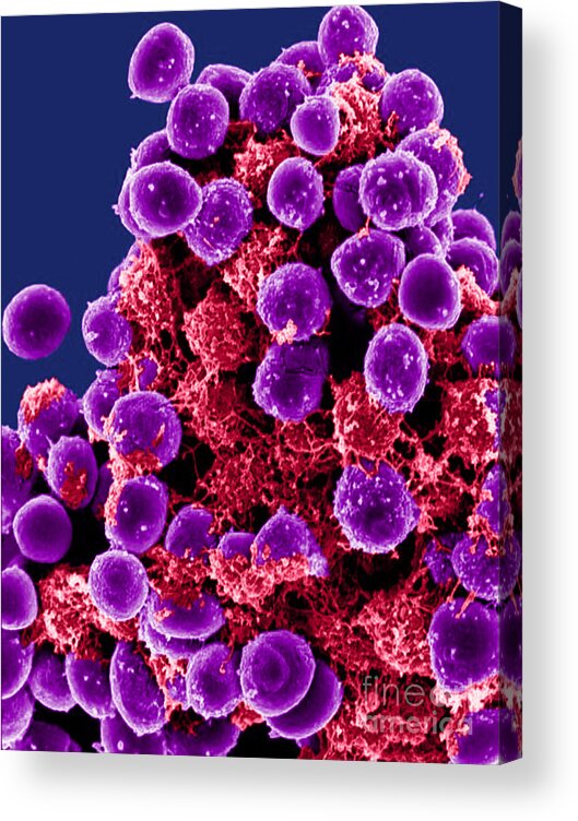 Microbiology Acrylic Print featuring the photograph Staphylococcus Epidermidis Bacteria, Sem #3 by Science Source