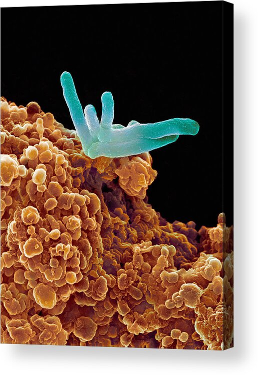 Mycobacterium Tuberculosis Acrylic Print featuring the photograph Bacteria Infecting A Macrophage, Sem #6 by 