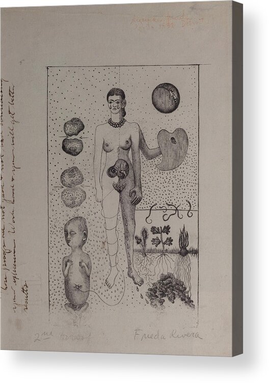 Frida Kahlo Acrylic Print featuring the painting Frida and the Miscarriage by Frida Kahlo