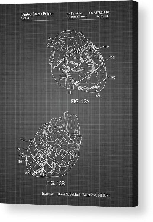 Pp702-black Grid Anatomical Heart Poster Acrylic Print featuring the digital art Pp702-black Grid Anatomical Heart Poster by Cole Borders