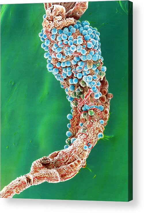 Anopheles Stephansii Acrylic Print featuring the photograph Colour Sem: Malaria Oocysts On Stomach Of Mosquito by London School Of Hygiene