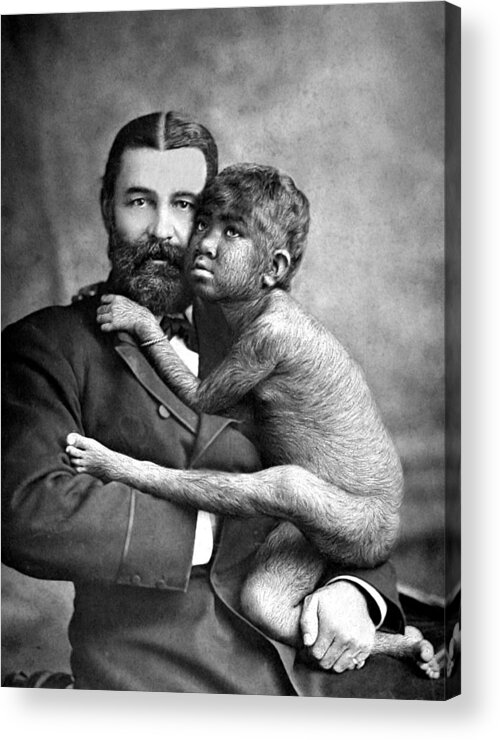 1880s Acrylic Print featuring the photograph The Great Farini With Krao, 1883 by Science Source