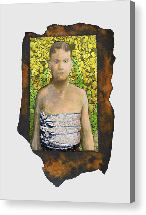 Glass Acrylic Print featuring the mixed media Fig. 69. Fractured ribs. by Matthew Lazure