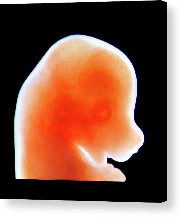 Mouse Acrylic Print featuring the photograph Mouse Embryo by Craig Rhodes And Kenneth Yamada/lcdb/nidcr/national Institutes Of Health
