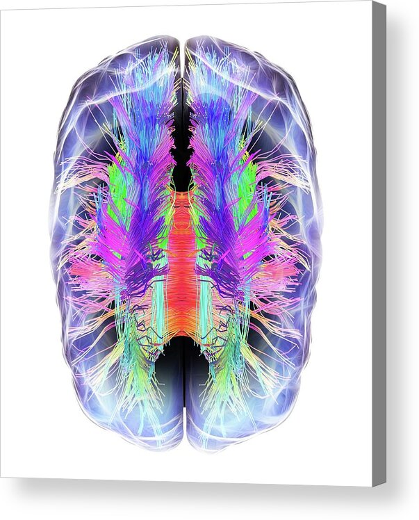 Brain Acrylic Print featuring the photograph White Matter Fibres And Brain by Alfred Pasieka
