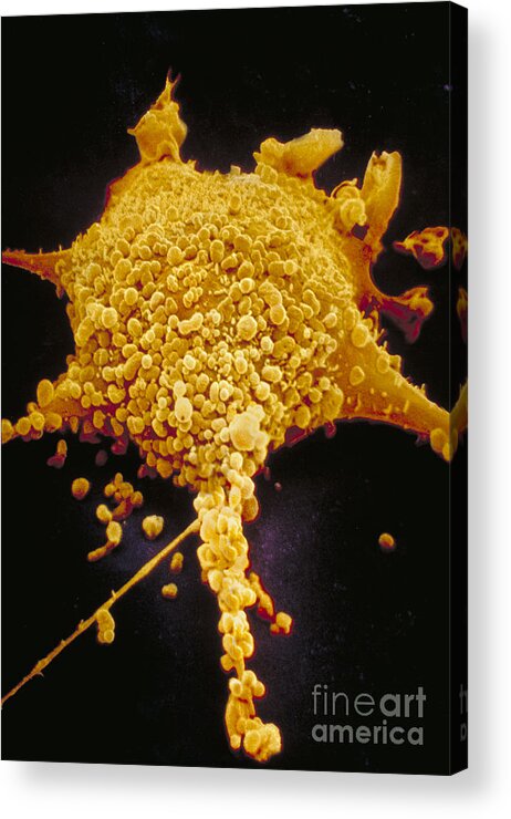 Mycoplasma Acrylic Print featuring the photograph Human Cell Infected With Mycoplasma by David M. Phillips