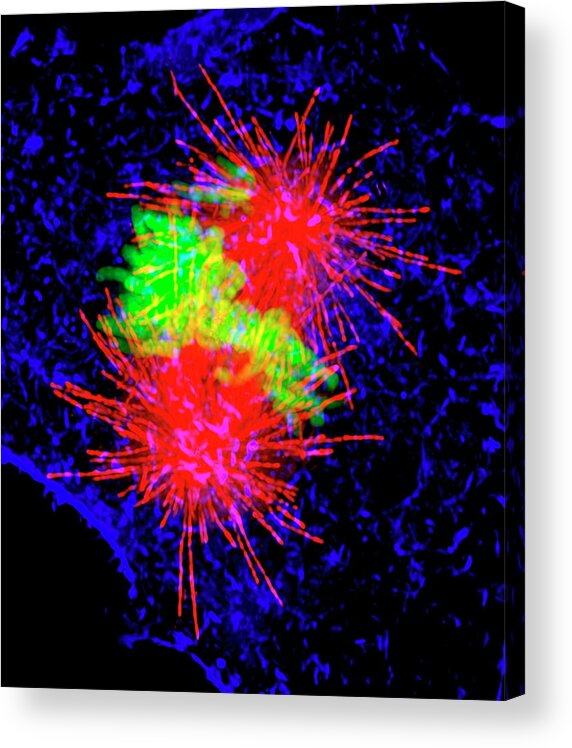 Mitosis Acrylic Print featuring the photograph Cancer Cell Division #3 by Dr Paul Andrews, University Of Dundee