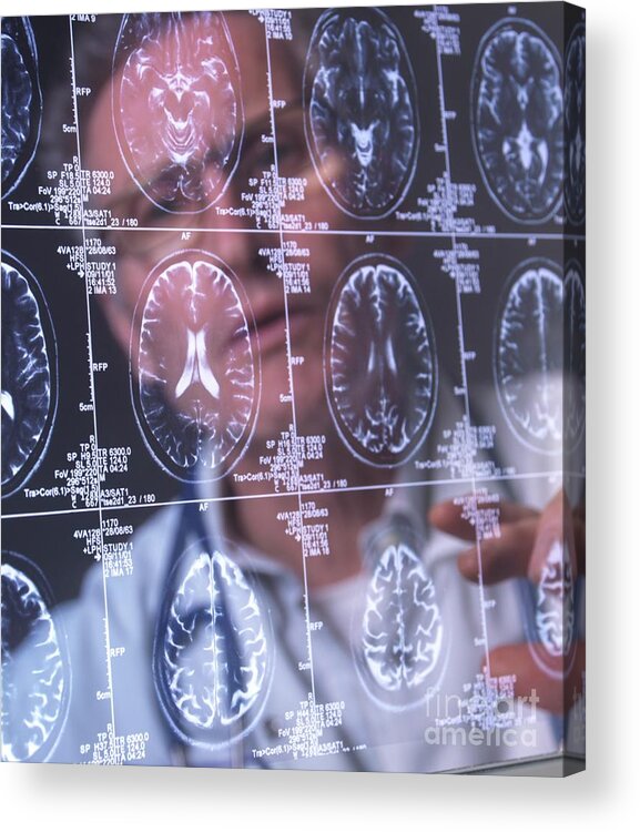 Dementia Acrylic Print featuring the photograph Neurology Diagnosis #13 by Tek Image/science Photo Library