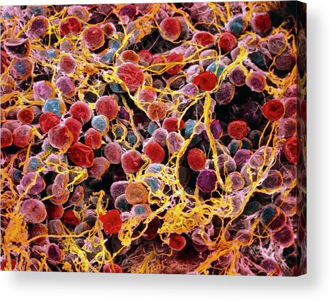 Magnified Image Acrylic Print featuring the photograph Coloured Sem Of Adipose Tissue Showing Fat Cells #1 by Prof. P. Motta/dept. Of Anatomy/university \la Sapienza\, Rome/science Photo Library